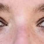 Recuperación tras una blefaroplastia Tu guia exhaustiva paso a paso
