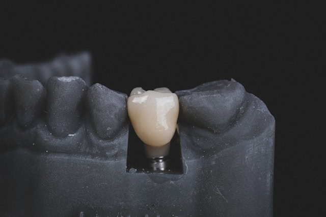 implantes pterigoideos